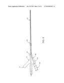 ULTRASOUND CATHETER AND METHODS FOR MAKING AND USING SAME diagram and image