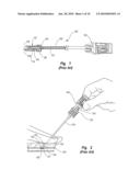 TISSUE PUNCTURE CLOSURE METHOD WITH DISENGAGABLE AUTOMATIC TAMPING SYSTEM diagram and image