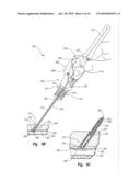 TISSUE PUNCTURE CLOSURE METHOD WITH DISENGAGABLE AUTOMATIC TAMPING SYSTEM diagram and image