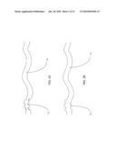 TETHER-ANCHOR ASSEMBLIES diagram and image