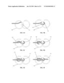 TETHER-ANCHOR ASSEMBLIES diagram and image