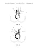 TETHER-ANCHOR ASSEMBLIES diagram and image