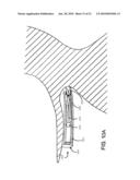 TETHER-ANCHOR ASSEMBLIES diagram and image