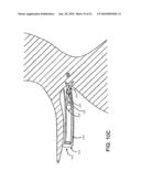 TETHER-ANCHOR ASSEMBLIES diagram and image