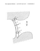 TETHER-ANCHOR ASSEMBLIES diagram and image