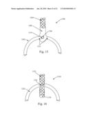 TETHER-ANCHOR ASSEMBLIES diagram and image