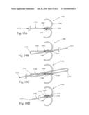 TETHER-ANCHOR ASSEMBLIES diagram and image