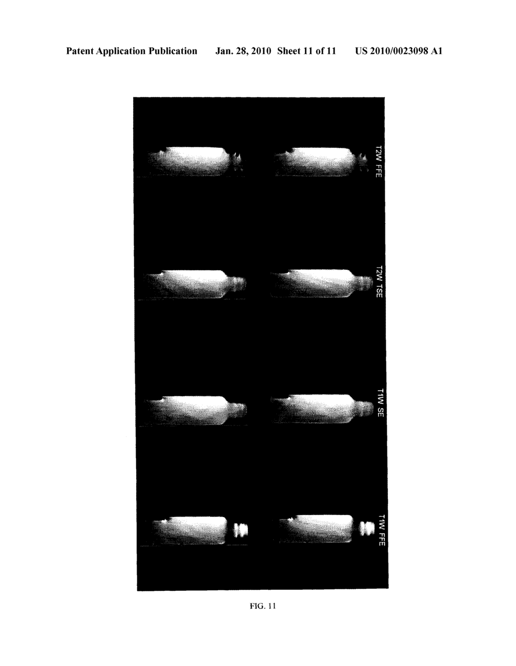 MEDICAL WARMING SYSTEM WITH NANO-THICKNESS HEATING ELEMENT - diagram, schematic, and image 12