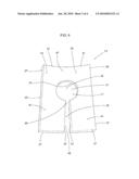 Marker Template for Breast Reduction Surgery diagram and image