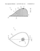 External breast prosthesis diagram and image