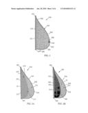 External breast prosthesis diagram and image