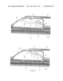 Windscreen Wiper Device diagram and image