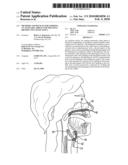 METHODS AND DEVICES FOR FORMING AN AUXILIARY AIRWAY FOR TREATING OBSTRUCTIVE SLEEP APNEA diagram and image