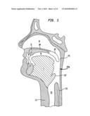 METHODS AND DEVICES FOR FORMING AN AUXILIARY AIRWAY FOR TREATING OBSTRUCTIVE SLEEP APNEA diagram and image