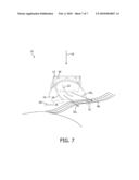 HAIR-STRAIGHTENING DEVICE diagram and image