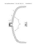 PRESSURE VESSEL HEAD WITH INVERTED NECK diagram and image