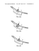 Appliance Access Door Strike Assemblies For Addressing Latch Operation Issues Arising From Dimensional Variances diagram and image