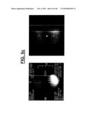 METHOD FOR RADIO-FREQUENCY NUCLEAR MAGNETIC RESONANCE IMAGING diagram and image