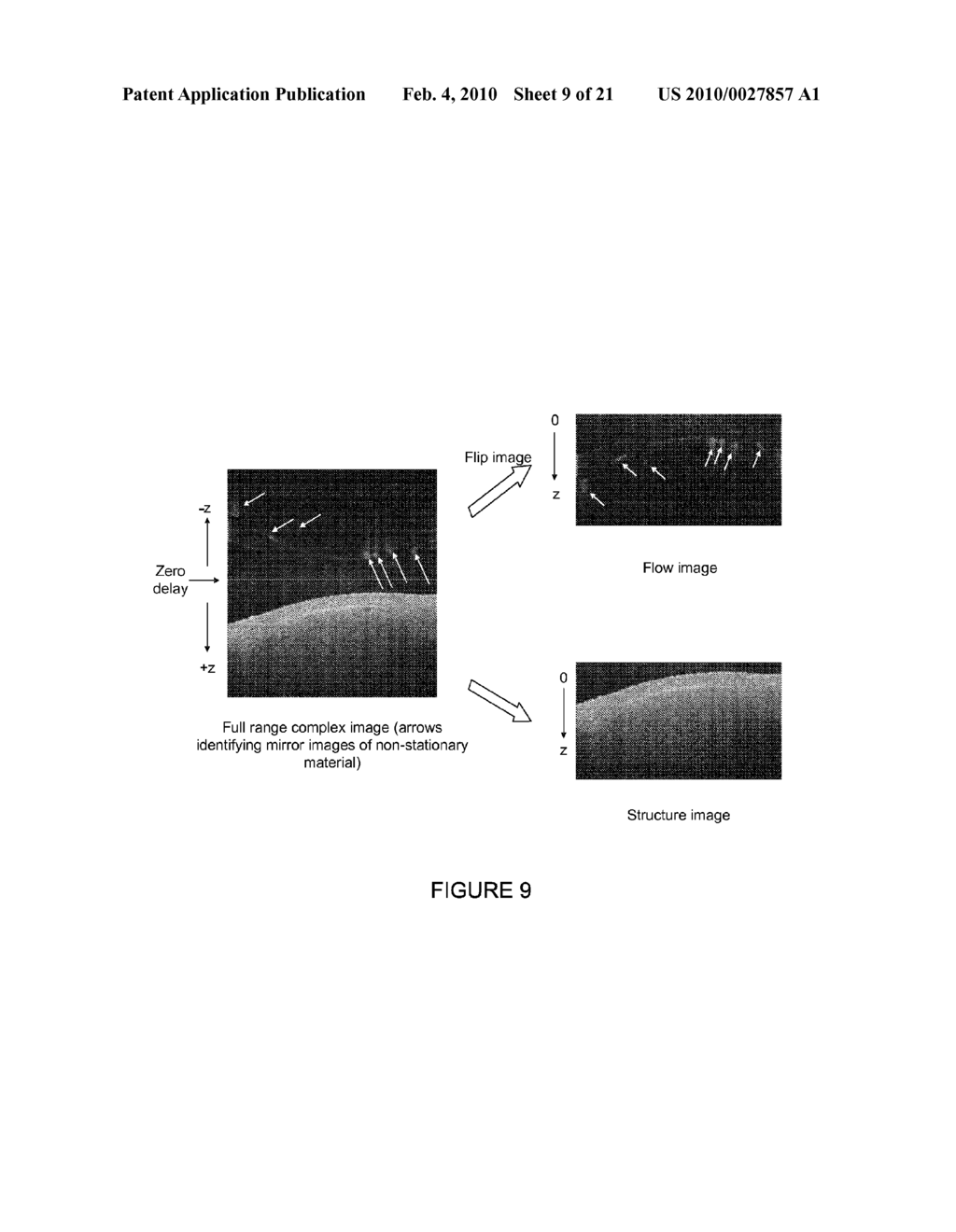 IN VIVO STRUCTURAL AND FLOW IMAGING - diagram, schematic, and image 10