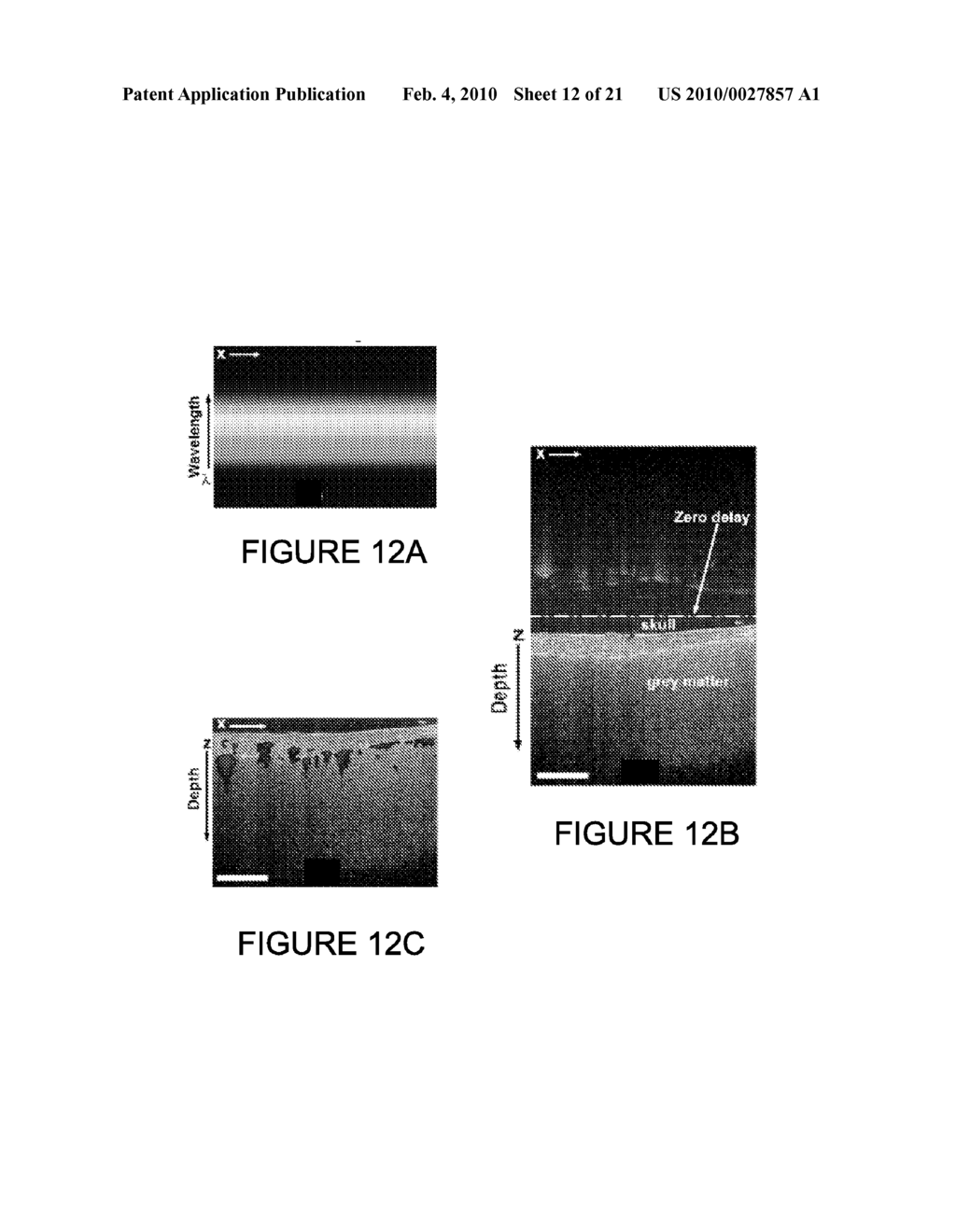 IN VIVO STRUCTURAL AND FLOW IMAGING - diagram, schematic, and image 13