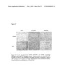 ANTIBODIES AGAINST VASCULAR ENDOTHELIAL GROWTH FACTOR RECEPTOR-1 diagram and image