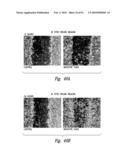 COMPOSITIONS AND METHODS FOR TREATING INFLAMMATION diagram and image