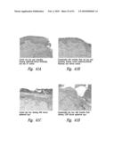 COMPOSITIONS AND METHODS FOR TREATING INFLAMMATION diagram and image