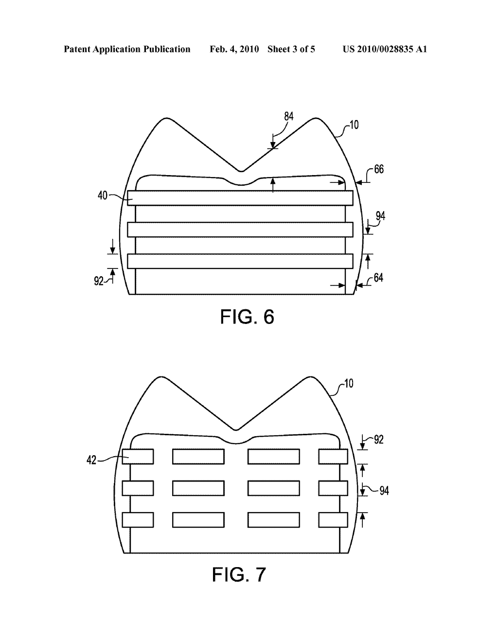 PEDODONTIC/VETERINARY DENTAL CROWN SYSTEM - diagram, schematic, and image 04