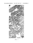 METHODS FOR MODELING INFECTIOUS DISEASE AND CHEMOSENSITIVITY IN CULTURED CELLS AND TISSUES diagram and image