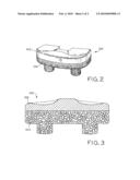 ANTIOXIDANT STABILIZED CROSSLINKED ULTRA-HIGH MOLECULAR WEIGHT POLYETHYLENE FOR MEDICAL DEVICE APPLICATIONS diagram and image