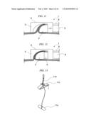 ENDOSCOPIC SURGICAL OPERATION METHOD diagram and image