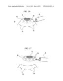 ENDOSCOPIC SURGICAL OPERATION METHOD diagram and image