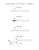 ENDOSCOPIC SURGICAL OPERATION METHOD diagram and image