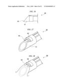 ENDOSCOPIC SURGICAL OPERATION METHOD diagram and image