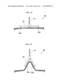 ENDOSCOPIC SURGICAL OPERATION METHOD diagram and image