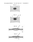 ENDOSCOPIC SURGICAL OPERATION METHOD diagram and image