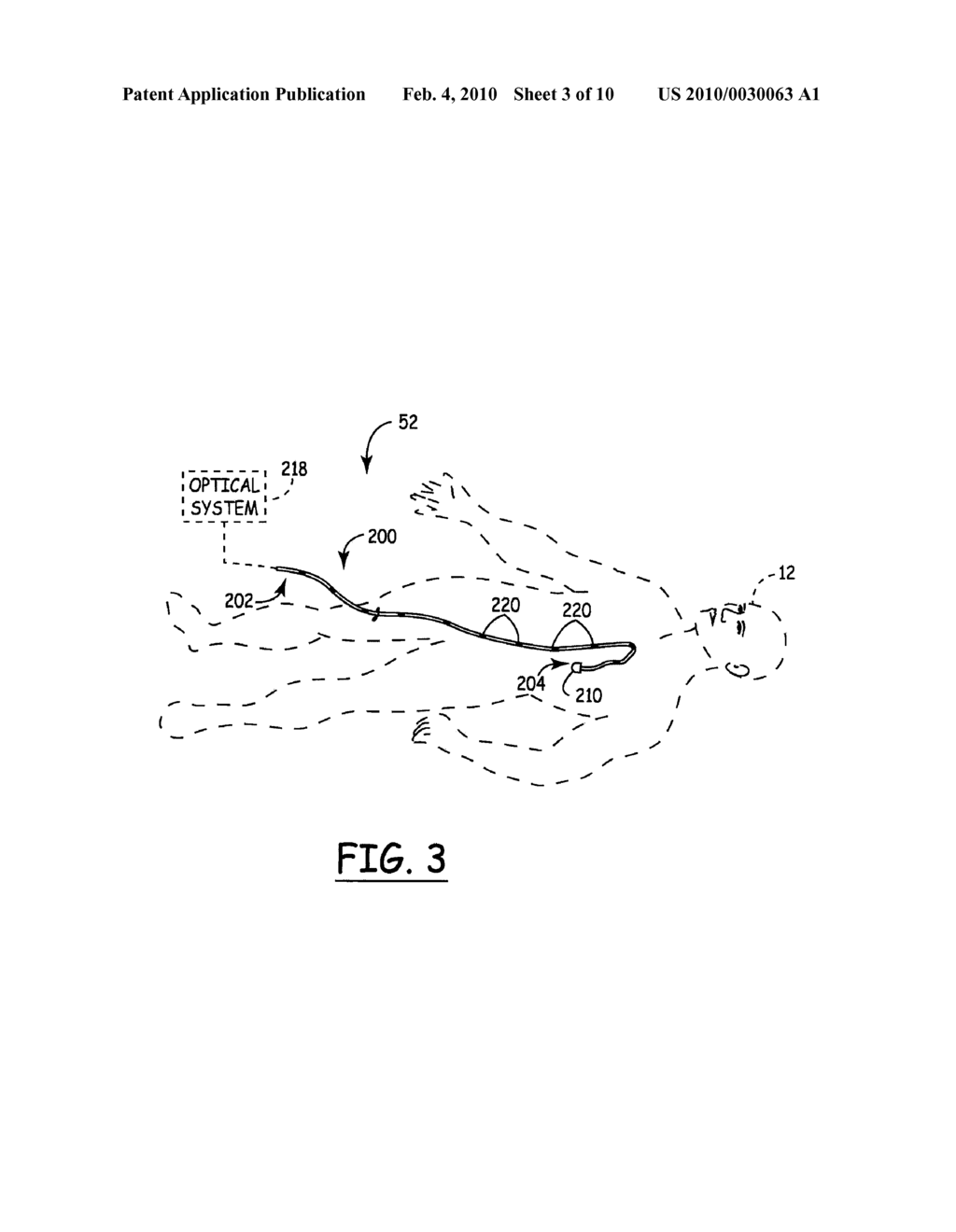 SYSTEM AND METHOD FOR TRACKING AN INSTRUMENT - diagram, schematic, and image 04