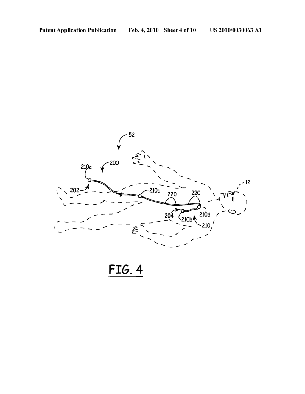 SYSTEM AND METHOD FOR TRACKING AN INSTRUMENT - diagram, schematic, and image 05