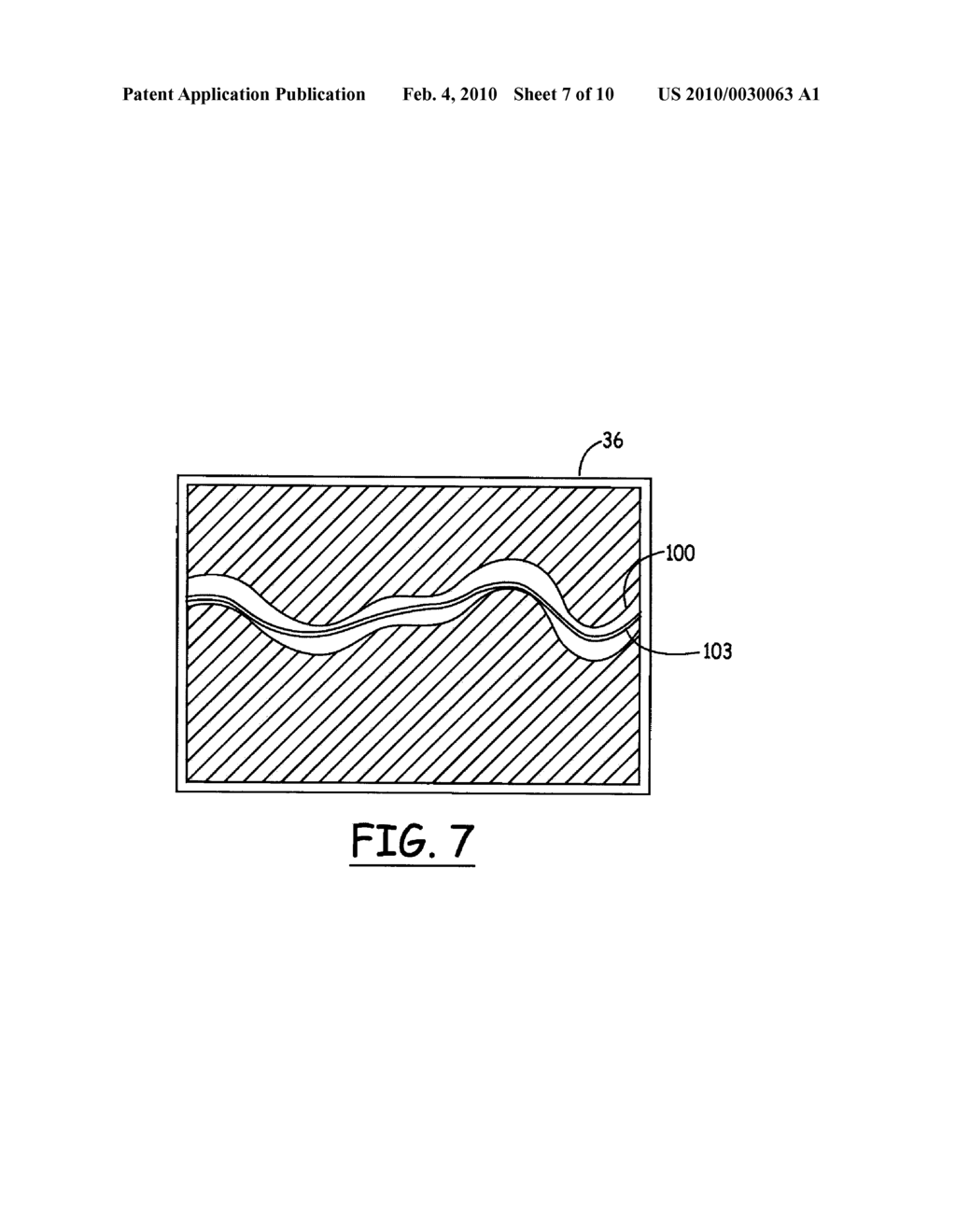 SYSTEM AND METHOD FOR TRACKING AN INSTRUMENT - diagram, schematic, and image 08