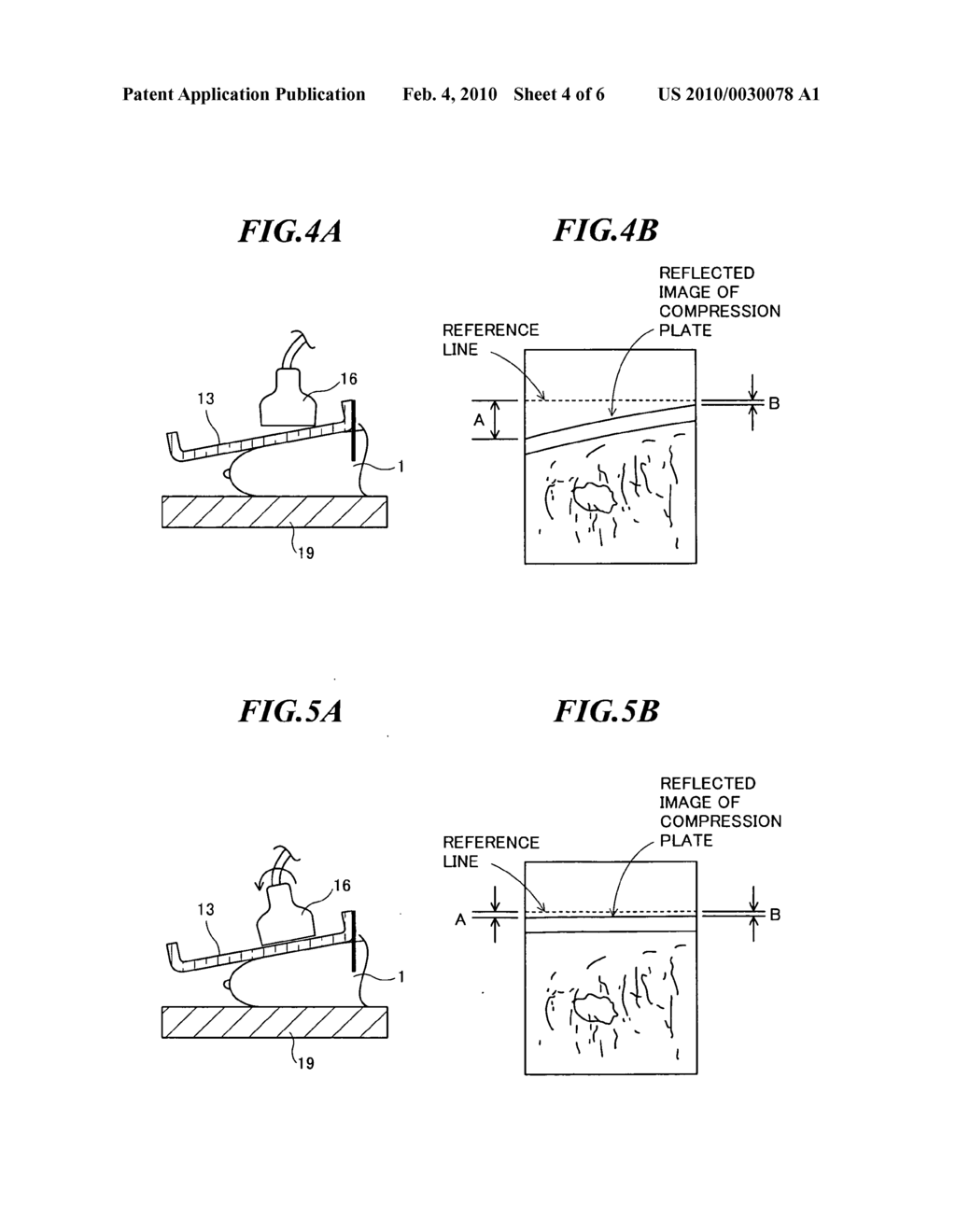 Medical imaging apparatus - diagram, schematic, and image 05