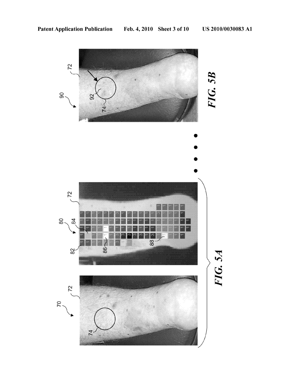 ASSESSMENT OF TISSUE RESPONSE TO STRESS - diagram, schematic, and image 04