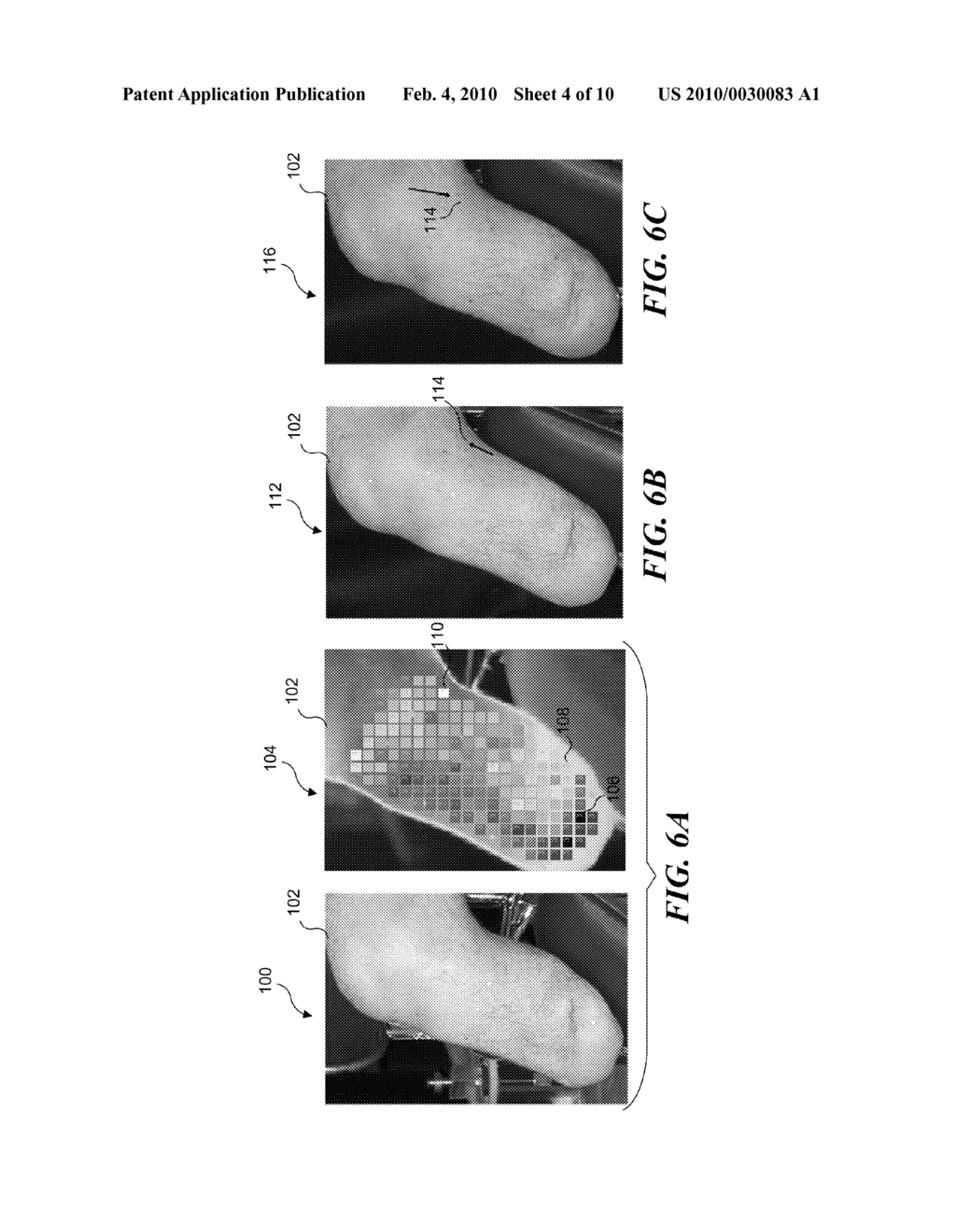 ASSESSMENT OF TISSUE RESPONSE TO STRESS - diagram, schematic, and image 05