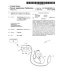 PERIODIC BEAT DETECTION TO DETECT ARTIFACTS IN A CARDIAC ELECTROGRAM diagram and image