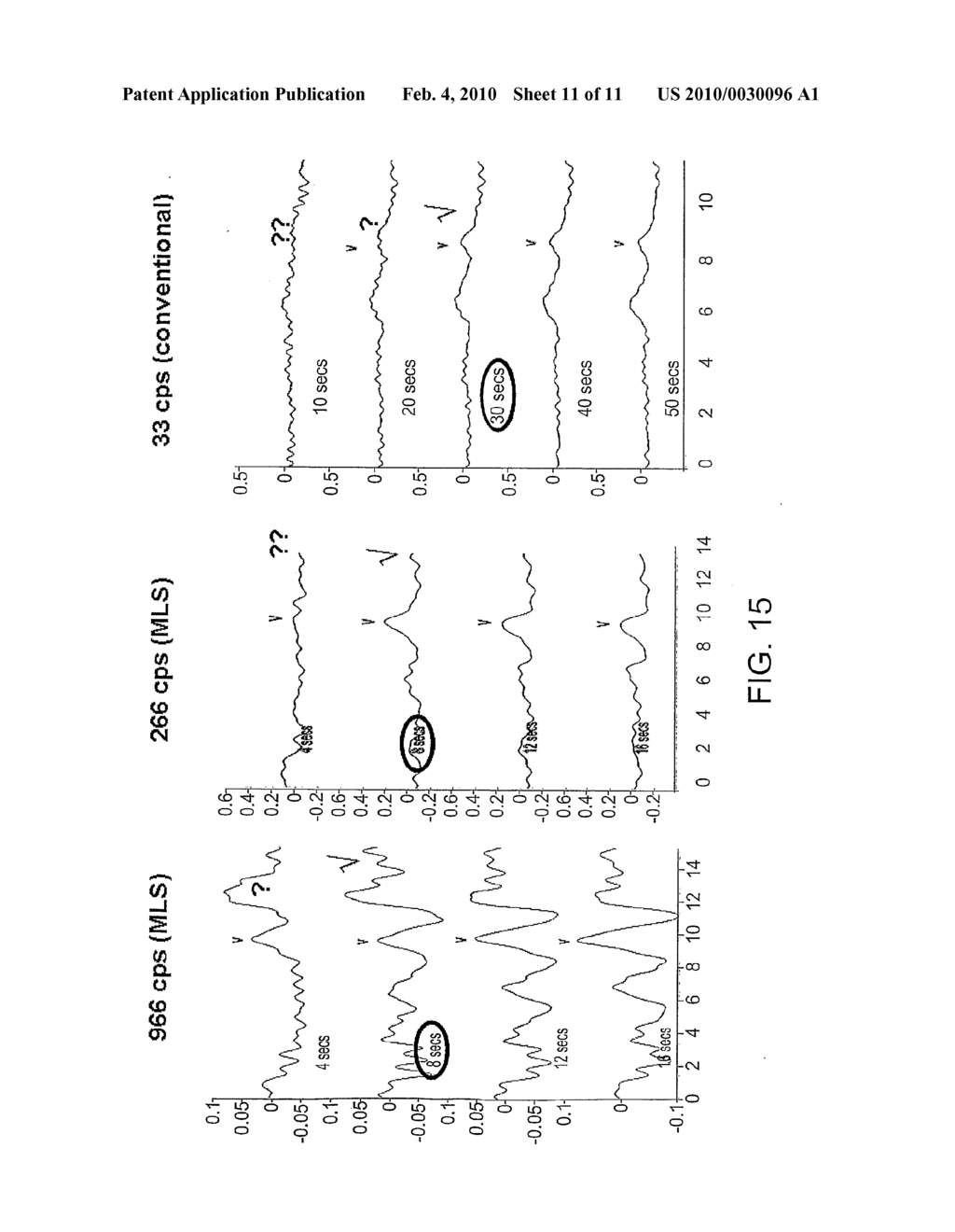 METHOD OF ACQUIRING A PHYSIOLOGICAL RESPONSE - diagram, schematic, and image 12