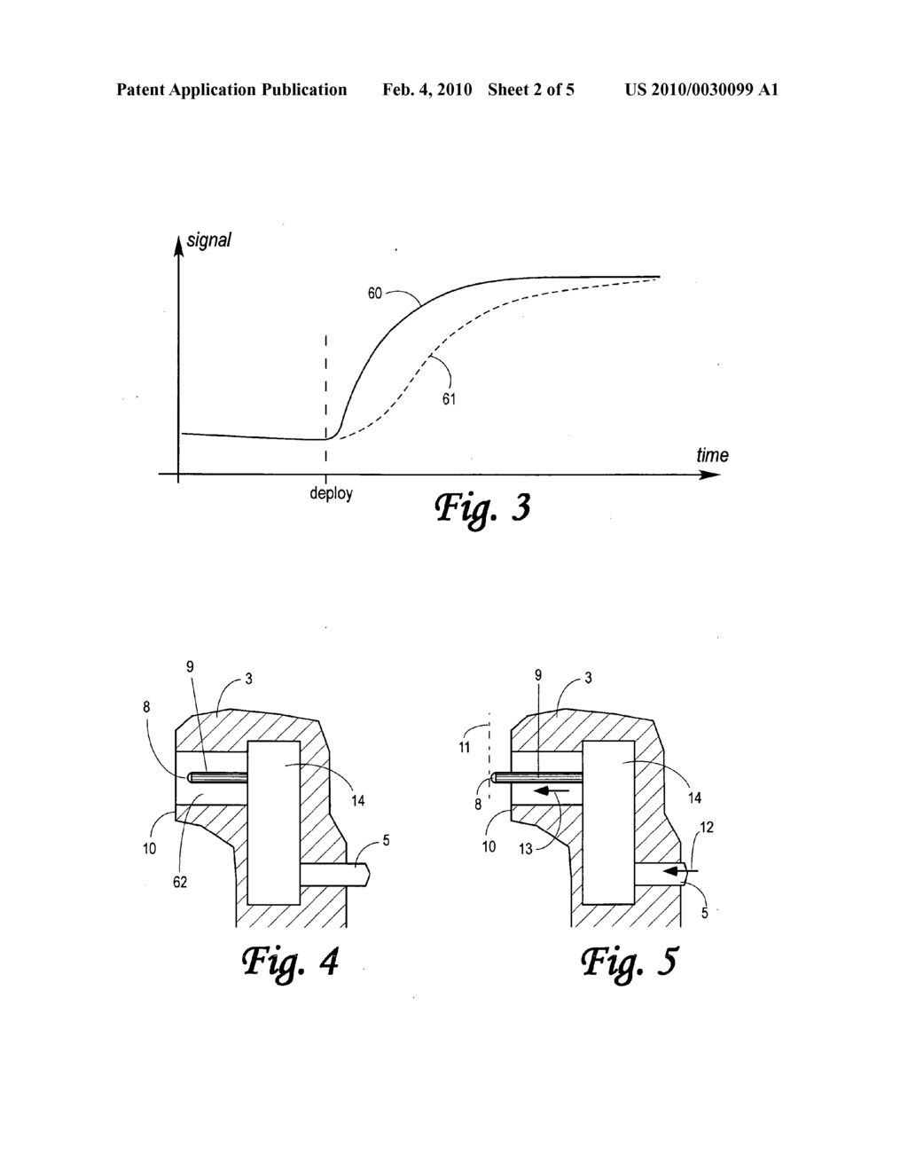 Medical Probe With Consistent Action - diagram, schematic, and image 03