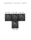 Active Delivery and Flow Redirections: Novel Devices and Method of Delivery of Materials to Patients diagram and image