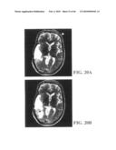 Active Delivery and Flow Redirections: Novel Devices and Method of Delivery of Materials to Patients diagram and image