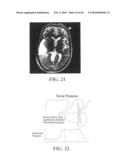 Active Delivery and Flow Redirections: Novel Devices and Method of Delivery of Materials to Patients diagram and image