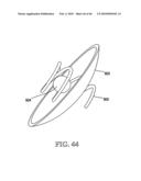 Active Delivery and Flow Redirections: Novel Devices and Method of Delivery of Materials to Patients diagram and image