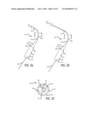 Paranasal Ostium Finder Devices and Methods diagram and image